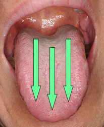 tonguecare01